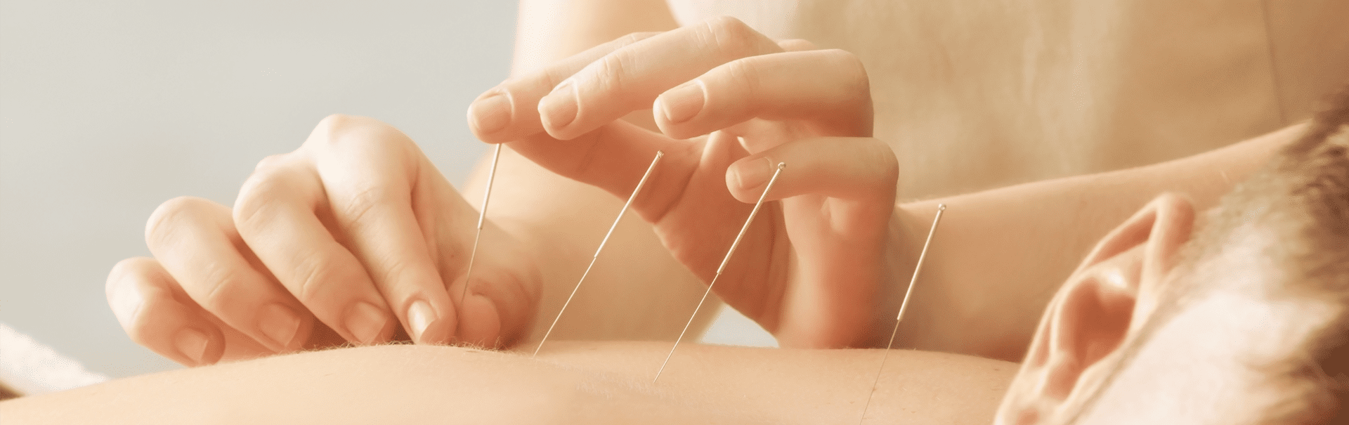 Why Get Regular Acupuncture Treatments