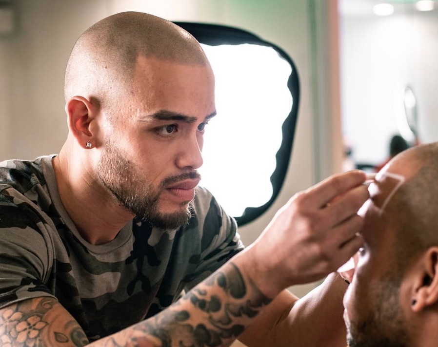 smp for Alopecia