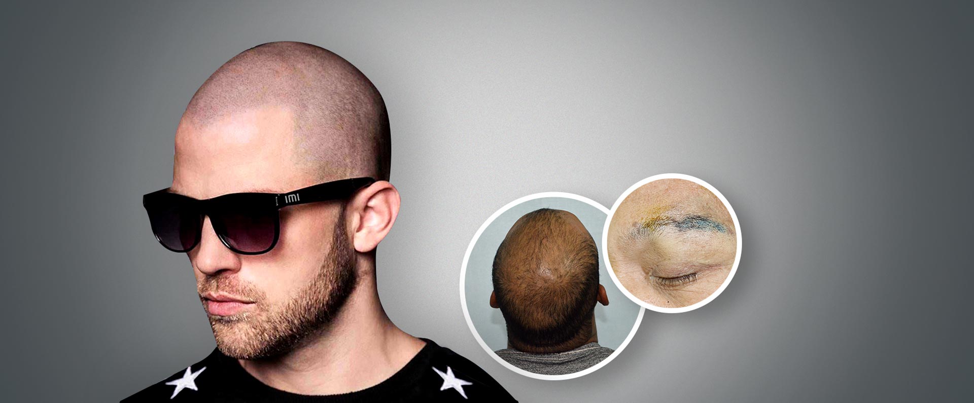 head tattoo