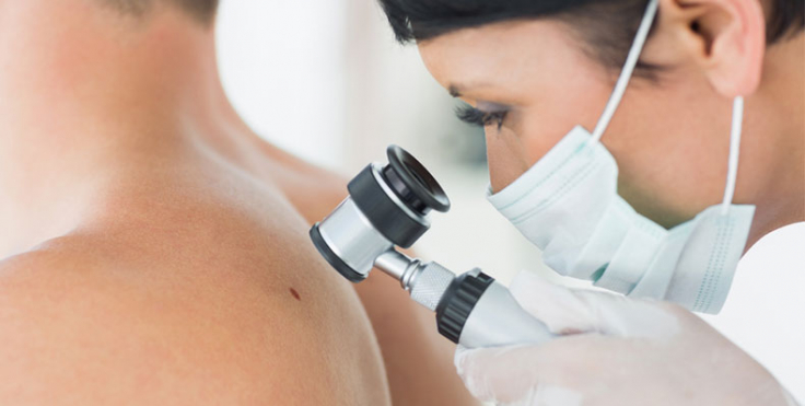 National Onsite Skin Cancer Checks